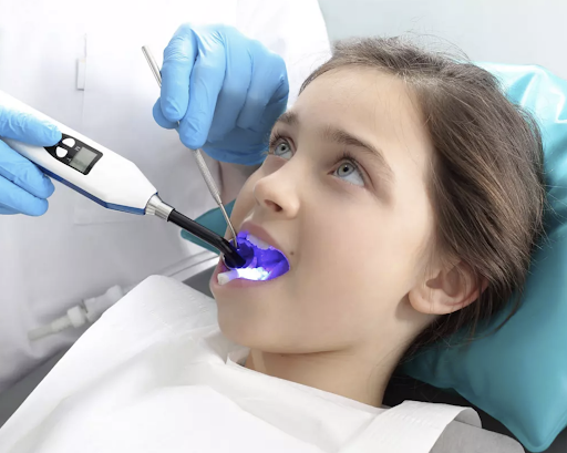 Child receiving dental sealants in Covina, CA at Dr. Jeffrey Cohen’s office.