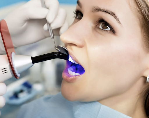 Adult receiving dental sealants in Covina, CA at Dr. Jeffrey Cohen’s office.
